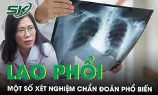 Một số xét nghiệm chẩn đoán lao phổi phổ biến hiện nay