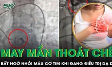 Đến viện chữa bệnh dạ dày bất ngờ lên cơn nhồi máu cơ tim nặng 