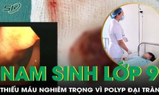 14 tuổi chỉ nặng 27kg, suy nhược nghiêm trọng vì polyp đại tràng gây chảy máu kéo dài