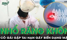 Cô gái ngã biến dạng mặt nghiêm trọng vì choáng ngất sau nhổ răng khôn