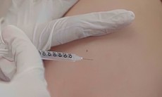 Trẻ 8 tuổi ở Đồng Nai tử vong do sởi, mẹ không tiêm vaccine vì 'bé không bị bệnh'