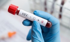 4 giải pháp thực hiện mục tiêu xét nghiệm HIV đến năm 2030