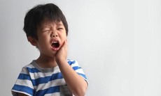 Trẻ bị viêm lợi sưng đỏ nên ăn gì để nhanh khỏi?