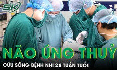 Cứu sống trẻ 28 tuần tuổi nhờ dẫn lưu não thất - ổ bụng điều trị não úng thủy