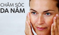 Sử dụng retinol trị nám cần lưu ý gì?