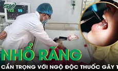 Cẩn trọng với ngộ độc thuốc gây tê khi nhổ răng