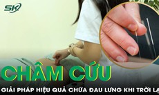 Châm cứu: giải pháp hiệu quả chữa đau lưng khi trời lạnh