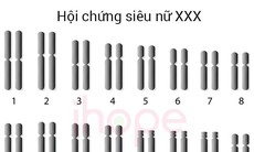 Tập vật lý trị liệu cho người mắc hội chứng siêu nữ