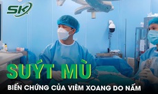 Cứu đôi mắt suýt mù vì biến chứng của viêm xoang do nấm