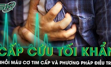 Các phương pháp điều trị bệnh nhồi máu cơ tim cấp