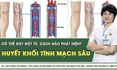 Huyết khối tĩnh mạch sâu có thể gây đột tử, cách nào phát hiện?