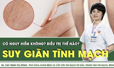 Suy giãn tĩnh mạch điều trị thế nào?