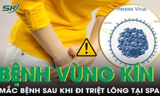 Lây bệnh khó nói cho chồng sau khi đi triệt lông vùng kín