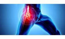 Trẻ sưng đau vùng háng, khó ngồi, cảnh giác với  viêm khớp háng 