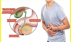 Sỏi mật khi nào cần phải mổ?