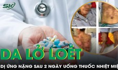 Da lở loét, bong tróc mảng lớn sau 2 ngày uống thuốc nhiệt miệng