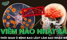 Viêm não Nhật Bản ủ bệnh trong bao lâu? Làm sao nhận biết?