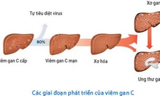 Cần làm gì để triển khai Kế hoạch điều trị viêm gan virus C ở người nhiễm HIV?