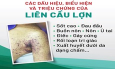 Sốt cao, đau nhức cơ, đi khám phát hiện mắc liên cầu lợn