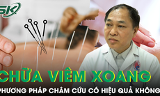 Châm cứu chữa viêm xoang có khỏi không?