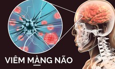Bài tập nào tốt cho người viêm não Nhật Bản?