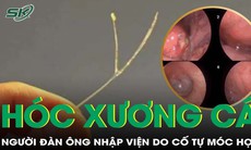 Cứu người đàn ông phù nề thanh quản do cố gắng móc xương cá bị hóc