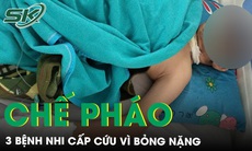 Tự mua thuốc nổ trên mạng về chế pháo, 3 bệnh nhi bỏng nặng