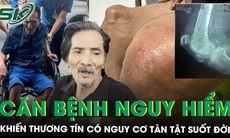 Thương Tín da bọc xương, nguy cơ tàn tật suốt đời vì căn bệnh nguy hiểm này