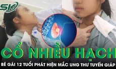 Thấy cổ nhiều hạch, bé gái 12 tuổi đi khám phát hiện mắc ung thư tuyến giáp