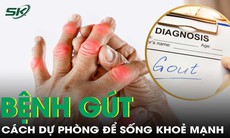 Phòng ngừa bệnh gout: Bí quyết đơn giản để sống khỏe