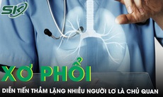 Bệnh xơ phổi diễn tiến thầm lặng, nhiều người lơ là chủ quan