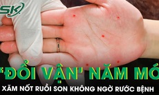 Xăm nốt ruồi son 'đổi vận': Vận chưa đổi đã rước thêm bệnh