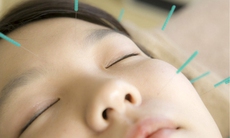 Thuốc và các phương pháp điều trị liệt mặt