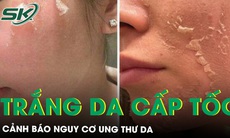 Cảnh báo lột da, tẩy trắng cấp tốc đón Tết nguy cơ ung thư da 
