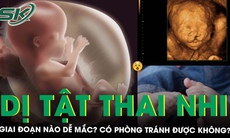 Giai đoạn nào thai nhi dễ bị dị tật và cách phòng tránh mẹ bầu cần biết 