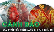 Cảnh báo nguy cơ lao phổi tiến triển nặng khi tự ý điều trị 