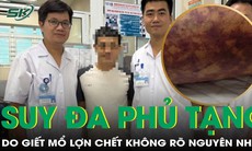 Suy đa phủ tạng do giết mổ lợn chết không rõ nguyên nhân