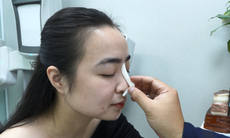 Trước khi nâng mũi cần biết những điều này