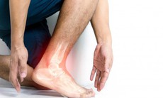 Dấu hiệu của bệnh gút dễ bỏ qua