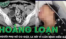 Hoảng loạn, hay la hét, người phụ nữ được phát hiện mắc bệnh lý viêm não tự miễn hiếm gặp