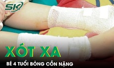 Xót xa bé gái 4 tuổi bỏng nặng do cồn