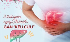 3 thói quen ngày Tết khiến gan tổn thương thường gặp