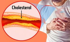 4 loại thực phẩm tốt nhất giúp giảm mức cholesterol