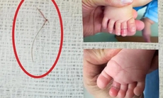 Bé gái 4 tháng tuổi suýt mất ngón chân vì sợi tóc nhỏ