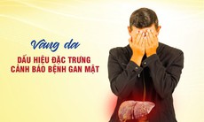 Vàng da - Dấu hiệu tổn thương gan cần chú ý