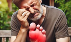 Gout: Nguyên nhân, triệu chứng, cách điều trị và phòng bệnh