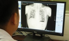 Nhiều công nhân mắc bụi phổi silic lo lắng khi nhận kết quả giám định