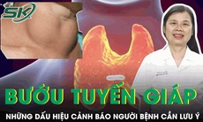 Những dấu hiệu cảnh báo tuyến giáp bất thường người bệnh cần đặc biệt chú ý