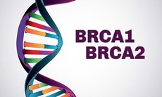Ai nên làm xét nghiệm đột biến gen BRCA để xác định nguy cơ di truyền ung thư vú?