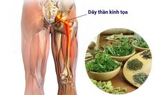 Bài thuốc trị đau thần kinh tọa do nhiều nguyên nhân